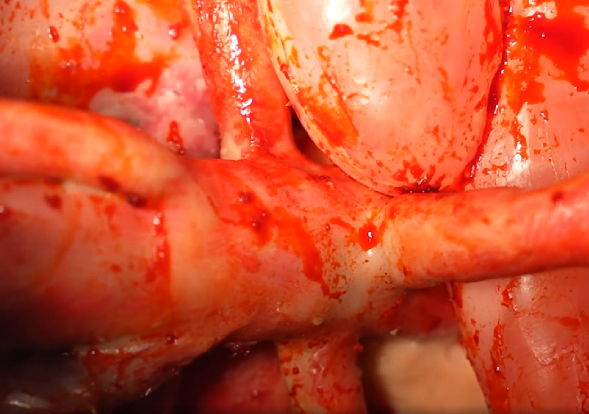 胸腹部損傷控制手術模擬人系統(tǒng)3.0