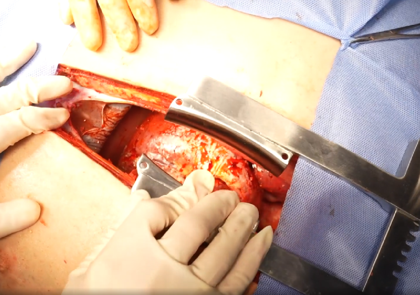 胸腹部損傷控制手術模擬人系統(tǒng)3.0